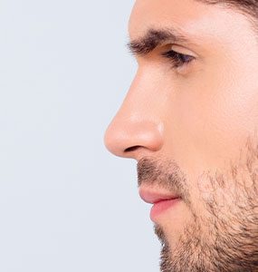 RHINOPLASTIE homme