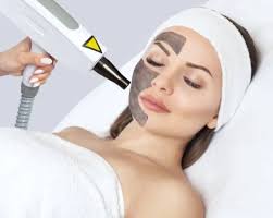 hollywood peel peeling laser carbone