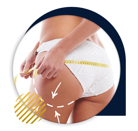 augmentation fesses implants au Maroc